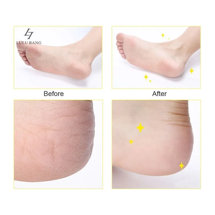 Electronic Pedicure Foot File Callus Remover Foot Care Tool Shaves